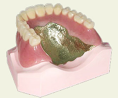 金床の入れ歯