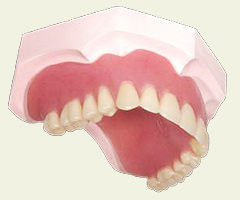 レジン床の入れ歯