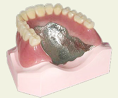 チタン床の入れ歯